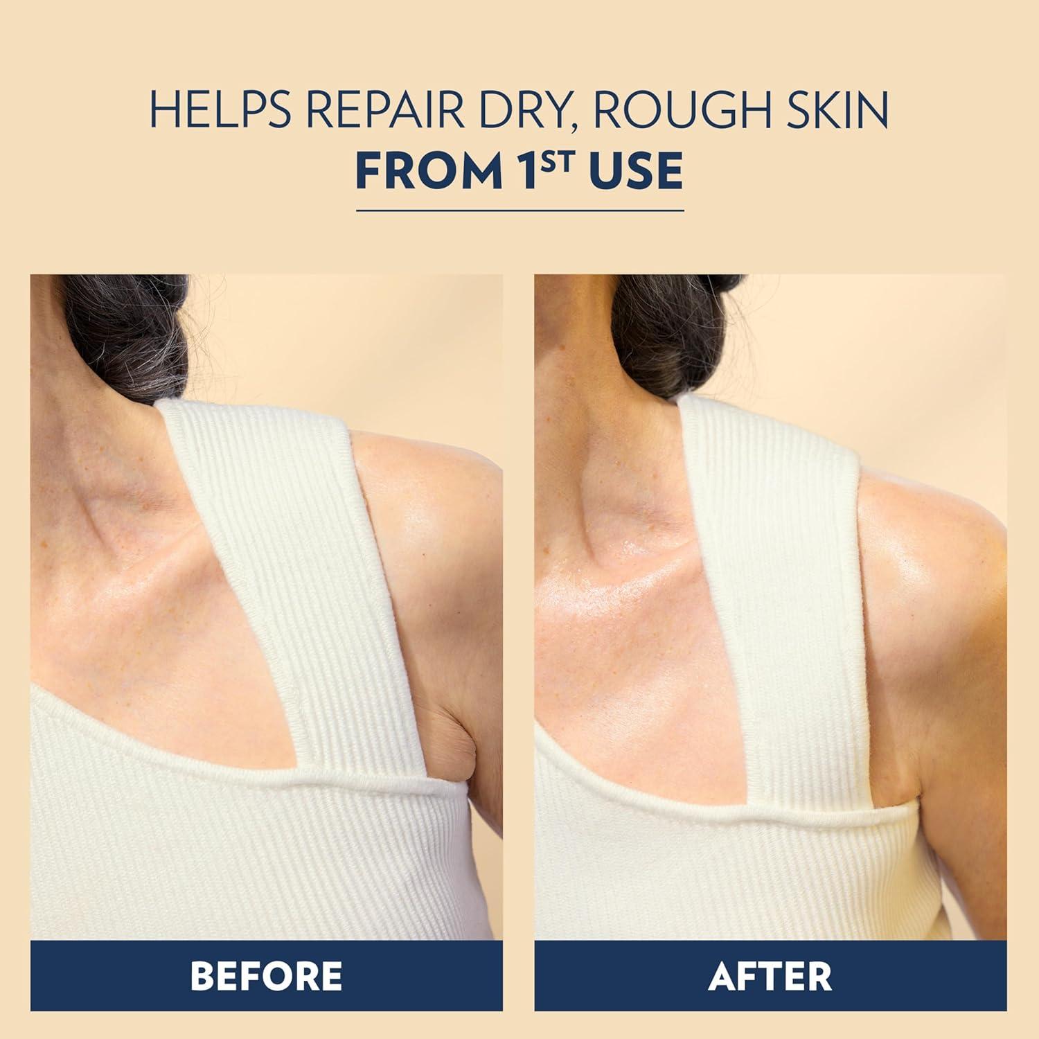 imageVaseline Advanced Repair Body Lotion Advanced Repair Unscented for Dry Skin Lotion Made with UltraHydrating Lipids and Vaseline Jelly That Repairs Extremely Dry Skin 203 Fl oz
