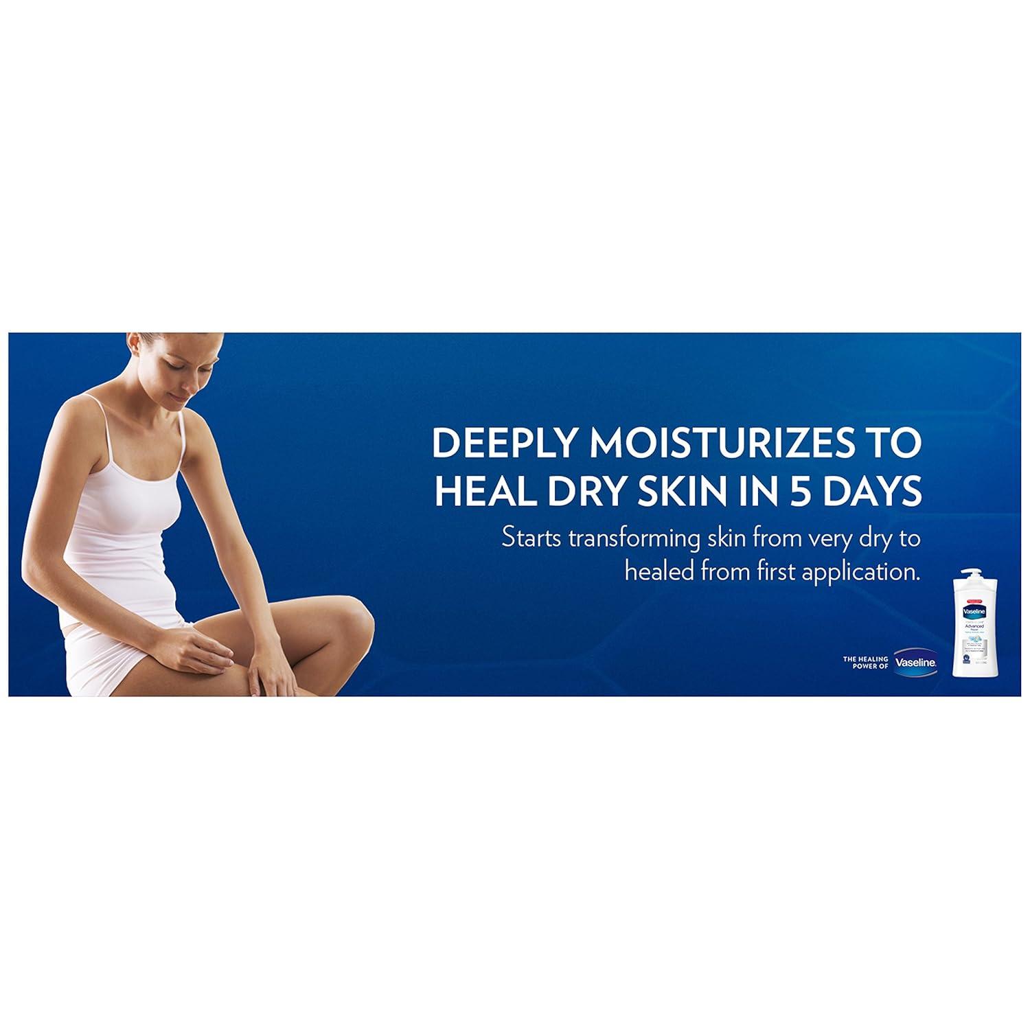 imageVaseline Intensive Care Body Lotion Advanced Repair Unscented for Dry Skin Lotion Made with UltraHydrating Lipids Vaseline Jelly to Repair Extremely Dry Skin 32 Fl oz