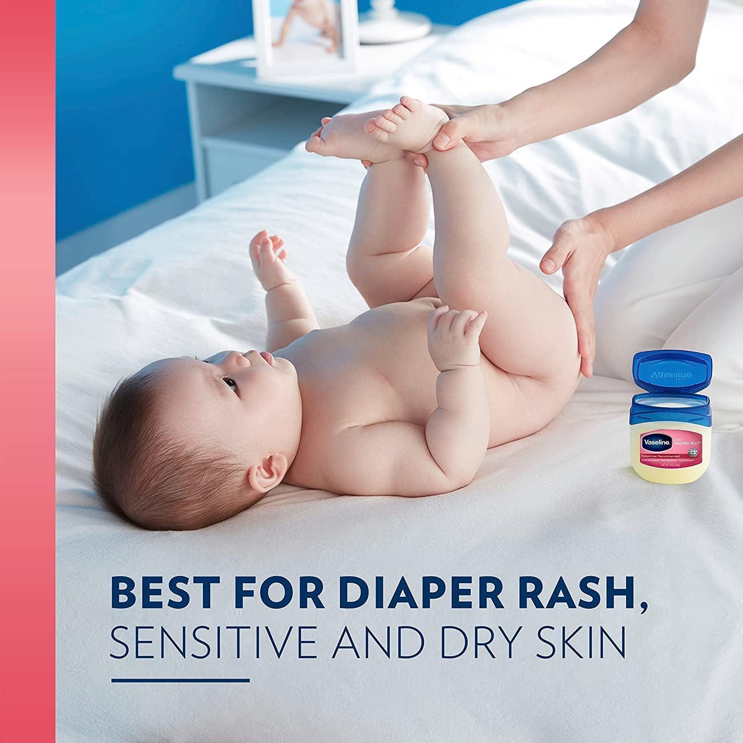 imageVaseline Petroleum Jelly Baby Skincare Protective amp Pure 4 Count Treats Dry Skin And Prevents Chaffed Skin From Diaper Rash Hypoallergenic And Gentle On Skin 13oz13 Ounce Pack of 4